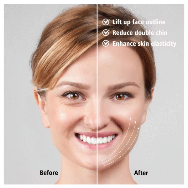 Dispositivo V Masajeador Facial Terapia Reducción Papada Top - Imagen 5