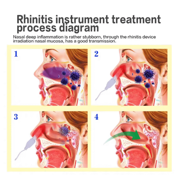 BioNase-terapia de curación para rinitis nasal - Imagen 3